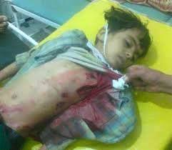 WahabismZionism's tweet photo. #Saudi Killing campain in
#Yemen #PAKISTAN #SayNoToSaudi #Terrorism #NsDontSendArmyToYemen #ShamelessNawaz http://t.co/289IevF8ei
