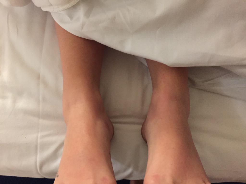 bazcook's tweet image. Which ones broken .... Errrr I don't know they both look deformed 😂😂😂 @julieaball @CWhyborne @c_whyborne 👠💓