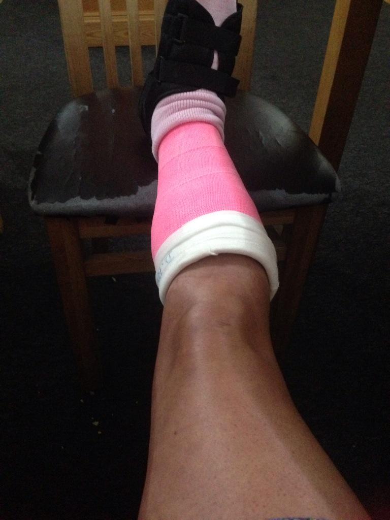 leahmtxxx's tweet photo. Cannot wait to get this thing off !#itchycast #missingmyheels #hate the shower !!!!!!! http://t.co/kRnjyQjgDv