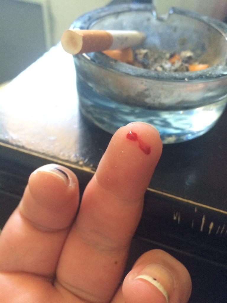 AndyxBones's tweet photo. Digging through my purse and cut my finger on a razor blade 🙉🙈 http://t.co/PWMyA0cdga