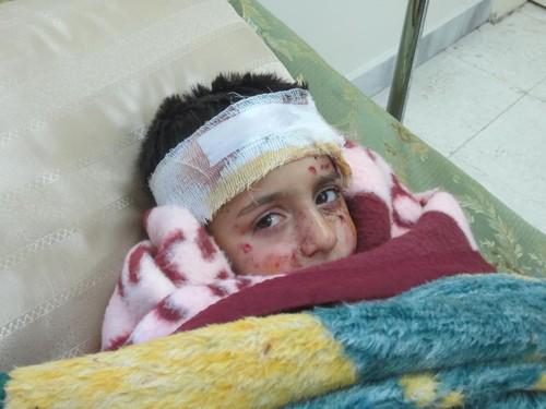 meljenp's tweet photo. “@Free_Media_Hub: http://t.co/xtKLalwlyv” if the world could feel ur pain.. #Action4Syria
