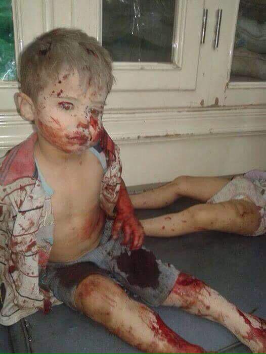 BrendaMcGlynn1's tweet image. In the name of humanity can nothing be done to stop this carnage #Yemen