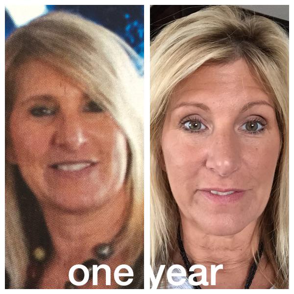 denabump's tweet photo. One year transformation. Down 15 lbs thanks to my gym n support team....aka hubby @Bumper13😘#workingoutworks http://t.co/cxPHZMaPT8