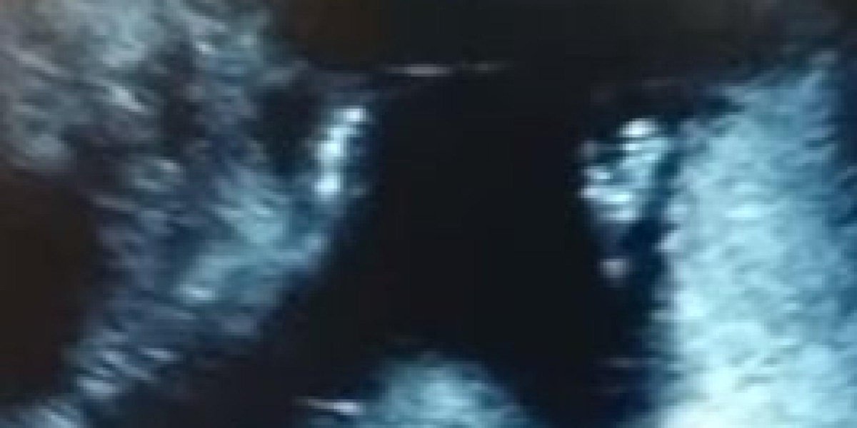HuffPost's tweet photo. Ultrasound appears to show fetus clapping to "If You're Happy And You Know It" 👏👏👏 http://t.co/VYnowkXNgJ http://t.co/uMZj6gZZzU