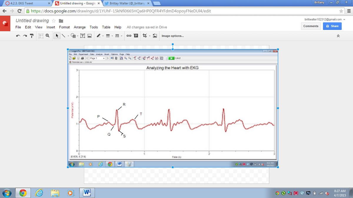 _brittanywalter's tweet photo. My EKG . #RHSBMS http://t.co/6TKluAfMq3