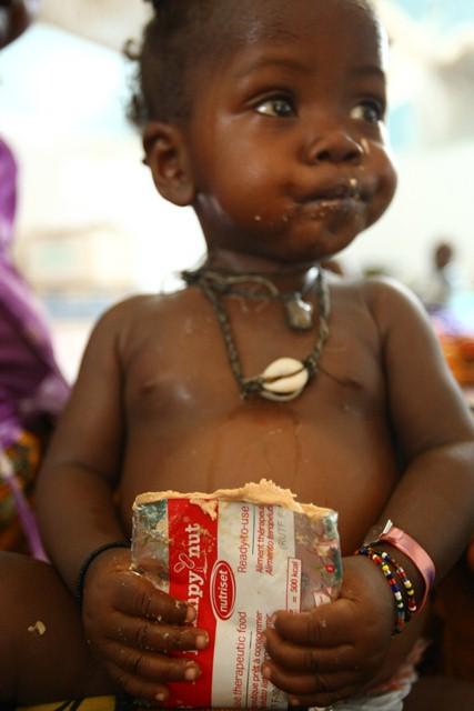 SaveChildrenEs's tweet photo. En el #DiaMundialdelaSalud hablemos de desnutrición y de cómo acabar con ella  http://t.co/D6wUpeUMY3 http://t.co/lzlEL9nJXp