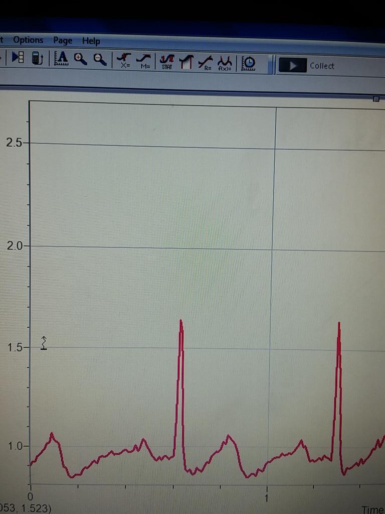 SamWilsonn25's tweet photo. EKG #rhsbms http://t.co/VzLqkQKRnu