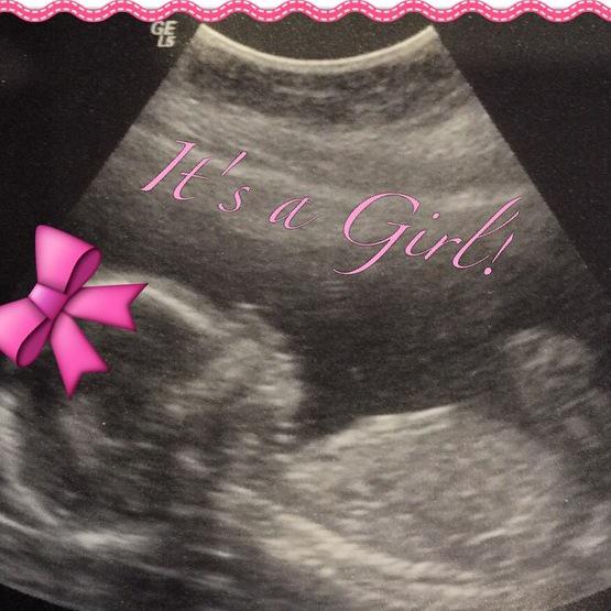 My niece 😍 
I can't wait to meet you princess Unk is gonna spoil you 💖