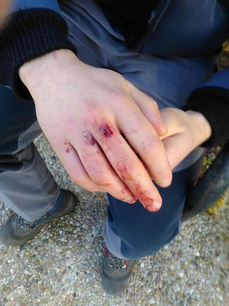 Errekaleor's tweet photo. Auzokide bat anbulantzian dago!!! Noraino iritsi nahi dute?? EZ DIEGU UTZIKO AUZOA UKITZEN!!! @topatuinfo @Ernaigazte http://t.co/MzvluaLOSN