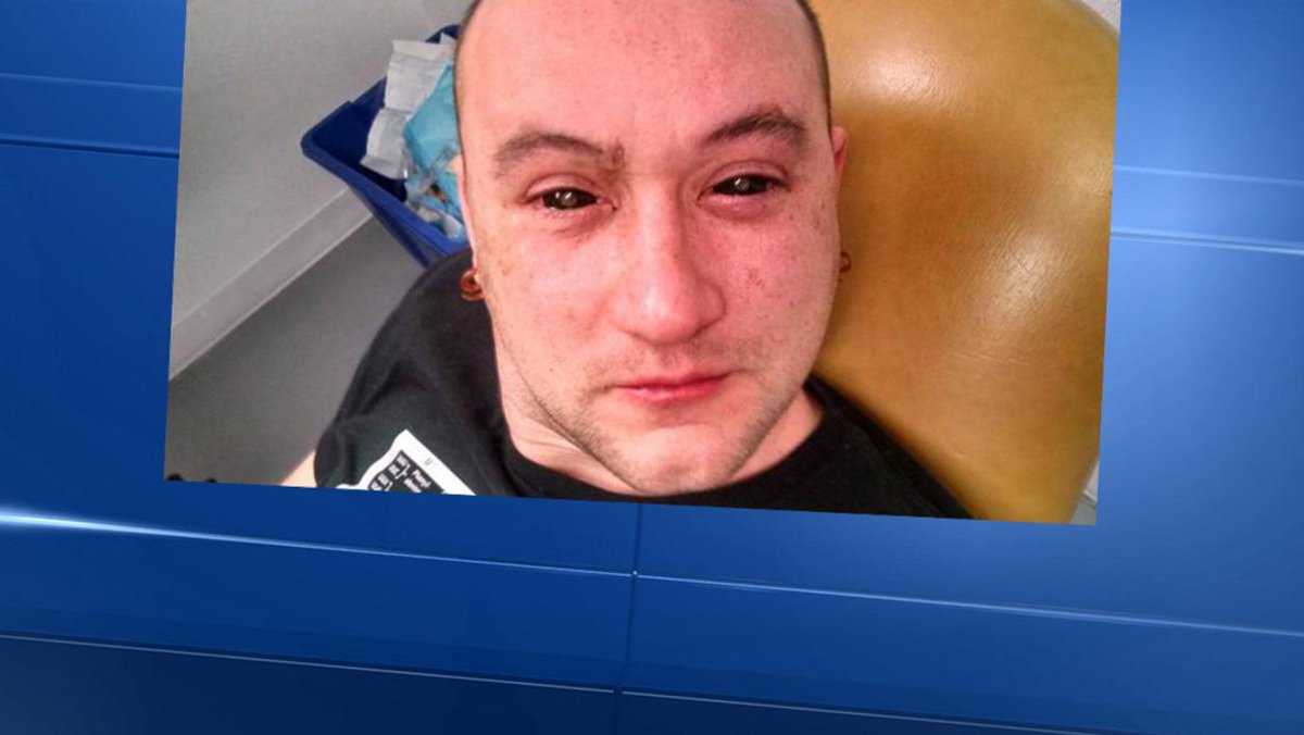 JeanLeseche's tweet photo. “@BFMTV: Un Américain s'injecte du liquide dans les yeux pour voir dans le noir http://t.co/Jlc1Ipl1pf http://t.co/I6XzXfvioK”@ju_boubou