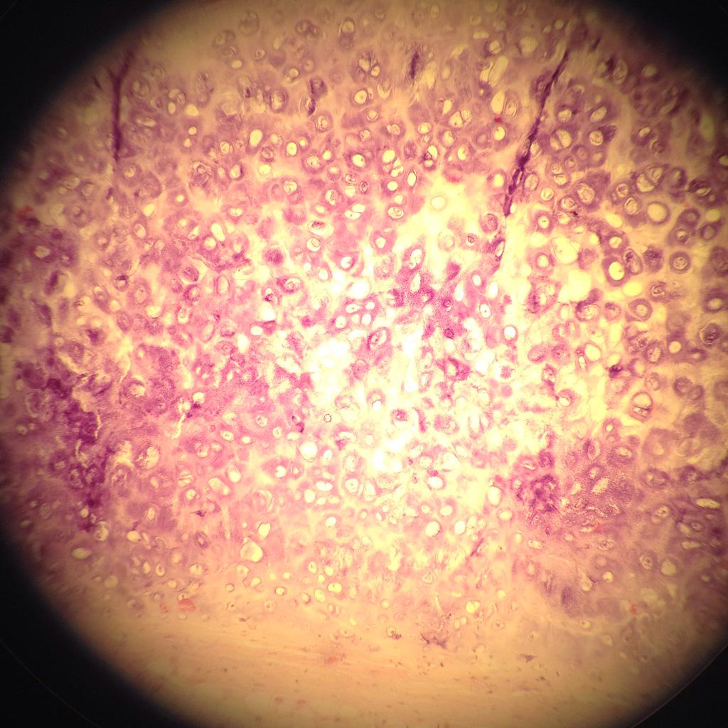 AKerkkonen's tweet photo. Tänään näkyi mikroskoopissa elastista rustoa eli kimmorustoa @ElastinenRR #lääkis #histology http://t.co/4ah5L5BSdQ