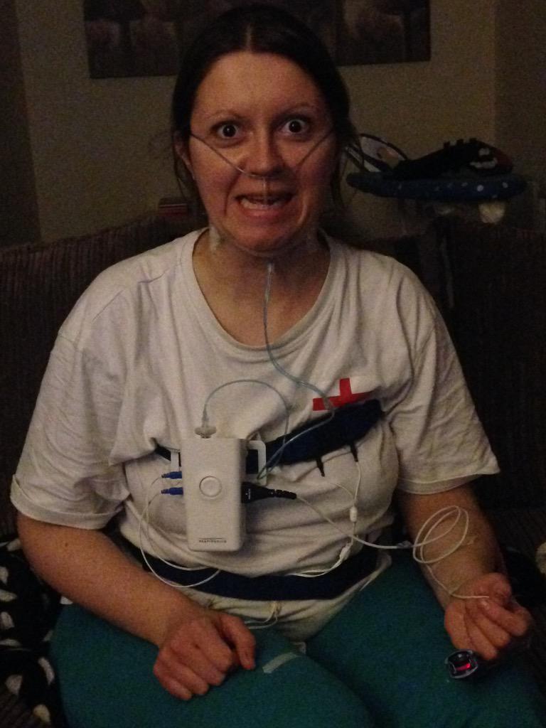 KaiPeacock5's tweet image. Look what I have to sleep with tonight @e_mitchinson #SleepApneaTest