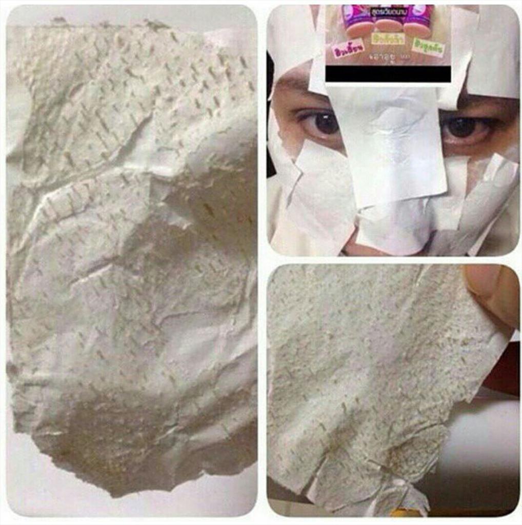 Melstuff_'s tweet image. No more facial ! No more pain ! Cukup 15-20 menit semua komedo terangkat.