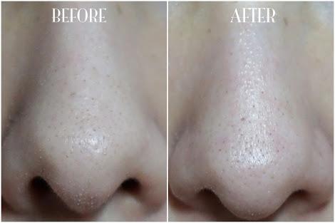 Melstuff_'s tweet image. Foto hasil pemakaian HUT MUN GEL