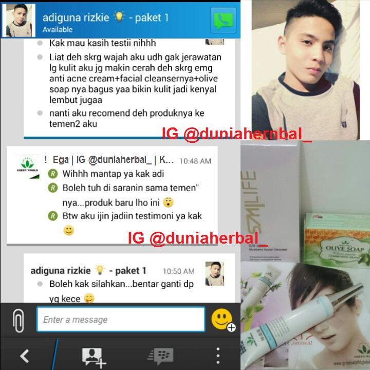duniaherbal_'s tweet photo. Kak adi pakai produk acne cream+cleanser+olive soap untuk kulitnya info/order : PIN BB : 31206823 WA : 08973198162 http://t.co/EBYFtauffS