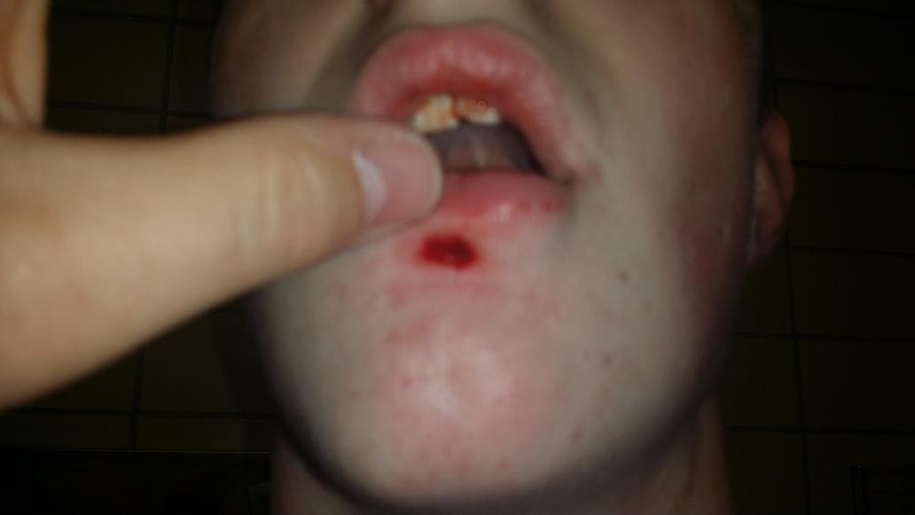 barney_oneill's tweet image. @Keegan_W3380 at the ER to get his first set of stitches. The first of many I&apos;m sure. #lowpost