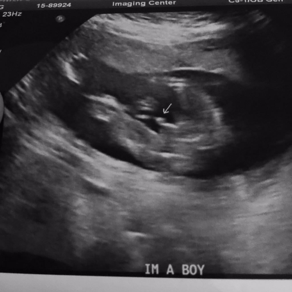 WoWMarketeer's tweet image. We are having a boy!