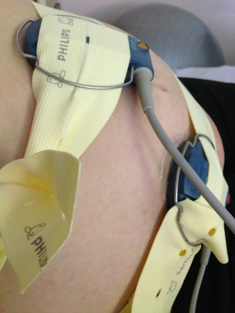 RustyComp's tweet image. #BabyUpdate  - back in again - 2nd time lucky!