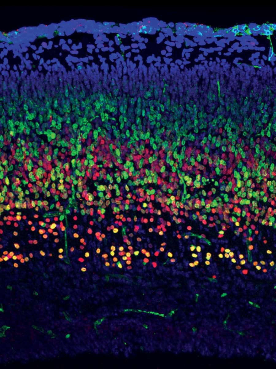 DonnellyCentre's tweet photo. Could #microexons be at the root of #autism? New study by @DonnellyCentre &amp; @MountSinai labs http://t.co/tasOVDiFdr http://t.co/YzRV4EjP0H