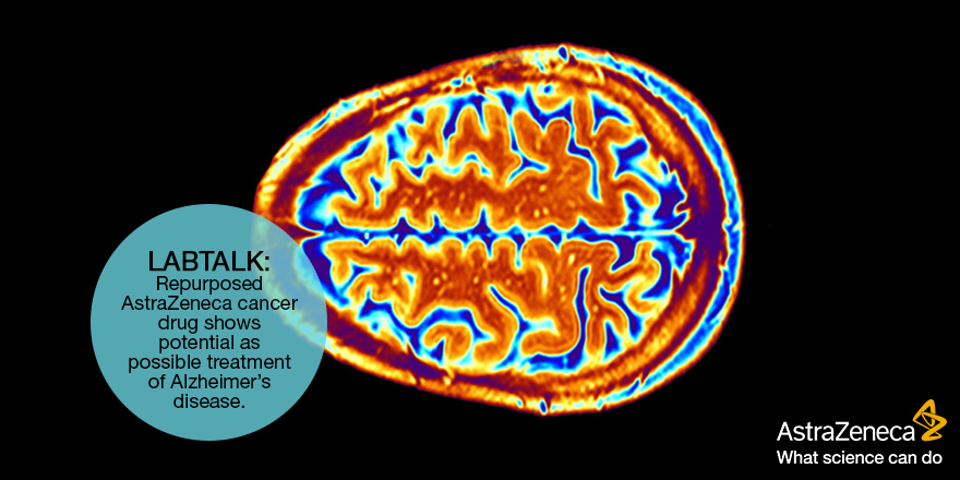 AstraZenecaJobs's tweet photo. A repurposed #AstraZeneca cancer drug might be a possible treatment of #Alzheimer’s: http://t.co/k0nDfjuO0C http://t.co/Ir2s2xAT27