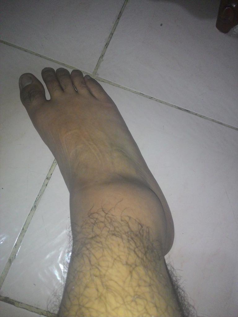 jjepm_'s tweet image. Akala ko last step na ng hagdan. May tatlo pa pala. 😭😭😭 #sprained #tanga
