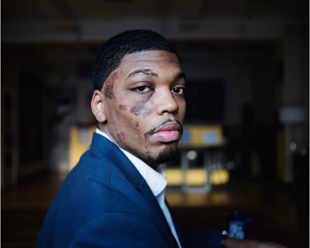 BuzzFeed's tweet photo. These portraits show homeless youth as they wish to be seen
http://t.co/k2VI4yymTB http://t.co/8p7i01mxgk