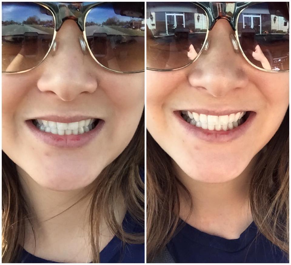 Gotta love a little 20 min pick me up whitening session!  Swing by and let us help you shine bright this weekend!