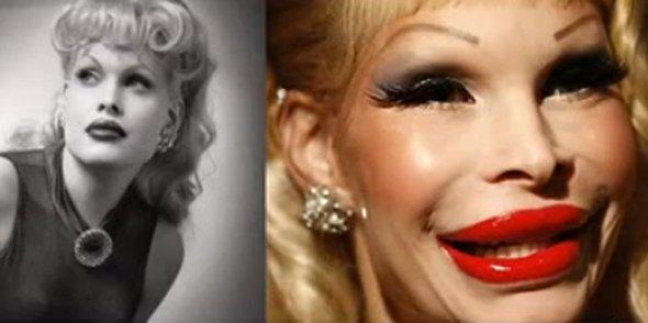 KnowFactsDaily's tweet photo. Worst Celebrity Plastic Surgeries Fail Of All Time (11 Pics)!
http://t.co/KtjVbqA8tk http://t.co/D0Xm5VCt1E