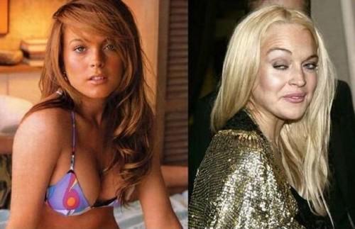 KnowFactsDaily's tweet photo. Shocking Celebs Drug Transformations (11 Pics)!
http://t.co/PfXSHeDImk http://t.co/b7J9zX4PWA