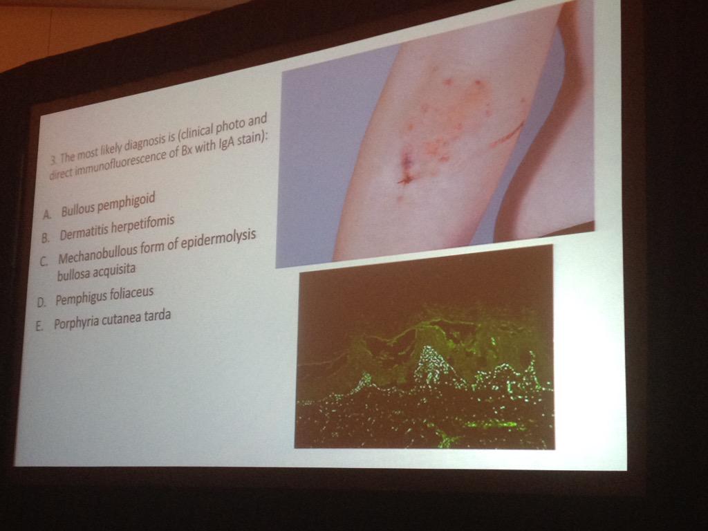 dr_schneiderm's tweet photo. What's your diagnosis? #ASDPEssentials #dermpath http://t.co/GMK3R62HGE