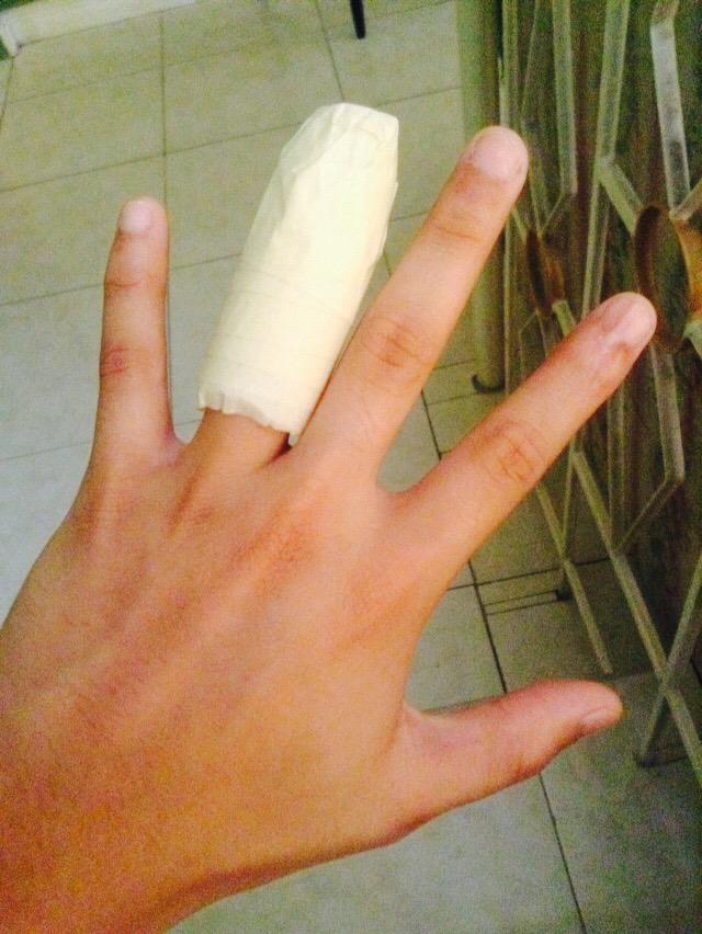 JedelleLulu's tweet image. Gumaling ka na please 😭😭😭 #dislocated