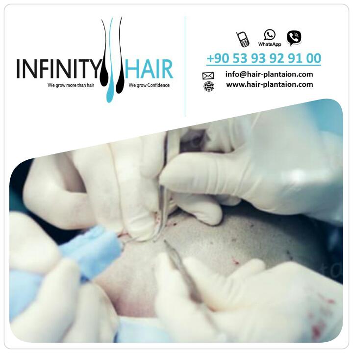 infinityturkey's tweet photo. #infinityhair
#hairtransplant
#turkey
#انفينيتي_هير #زراعة_الشعر #تركيا #السعودية #الكويت #قطر #البحرين #الامارات http://t.co/B3wustbtU6