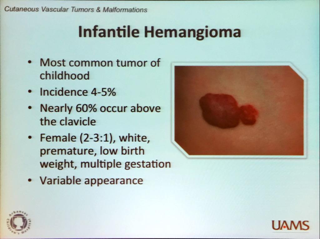 SkinCancerAR's tweet photo. Dr. Gresham Richter discusses infantile  hemangioma. Often regress but some need intervention #ASCC15 #dermatology http://t.co/5jhvJp2aQ7