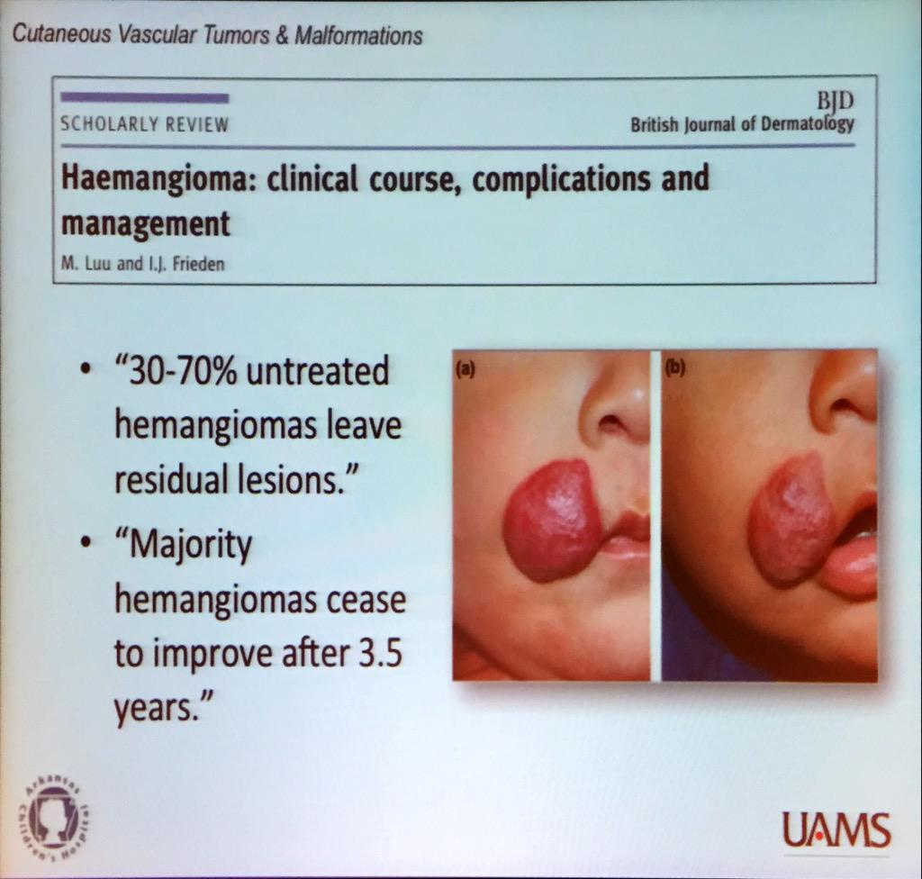 SkinCancerAR's tweet photo. Dr. Richter: many infantile hemangioma regress but leave some residual.Various treatment options #ASCC15 #dermatology http://t.co/XBjX62GDPQ