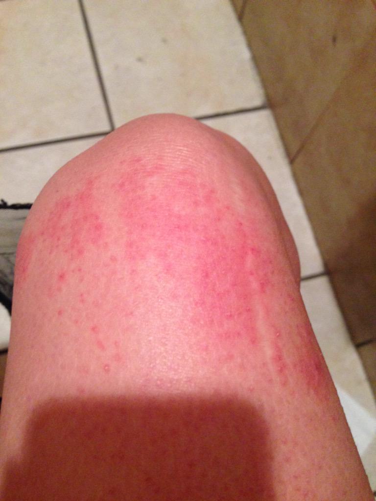 StephyDelicious's tweet image. Eff you, razor burn. #toilettalk