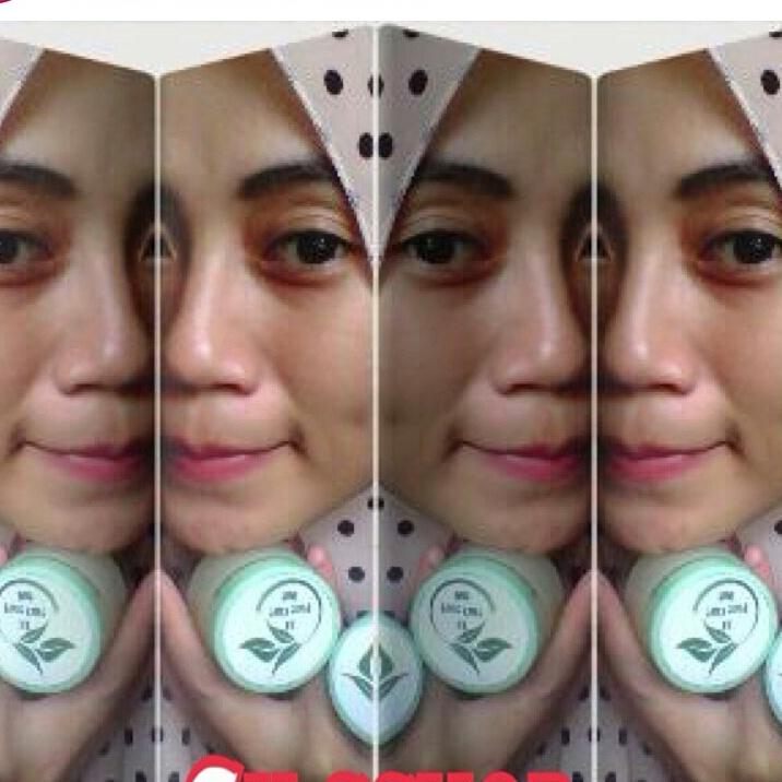 Indahhwang04's tweet photo. CA face care anti acne &amp; whitening http://t.co/M1iDRsd7Kd