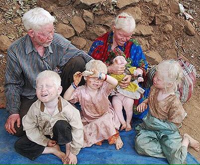 Join us on the 1 Angel Eyewear Campaign to collect  used and new sunglasses for kids with Albinism.

<a href="/1angelproject/">1 Angel Project</a>
