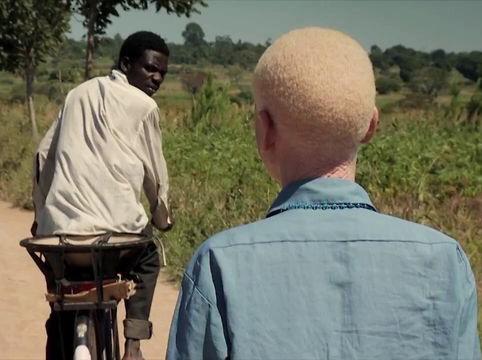 If u can't protect them at least don't hurt them. Together we can stop albinism killings.
<a href="/jesuisalbinos/">Je Suis Albinos</a>