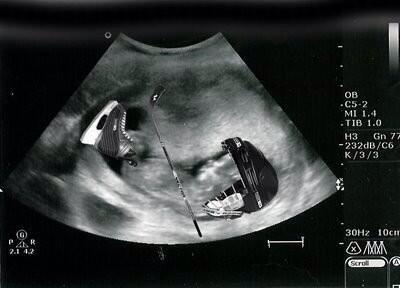 SavageAuston34's tweet photo. The early warning signs of a future beauty http://t.co/ALAbWiC8gx
