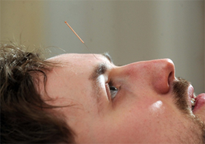 Facebook won't let us promote a rave #acupuncture review as it contains a 'shocking' image... bit.ly/1PmOEQe
