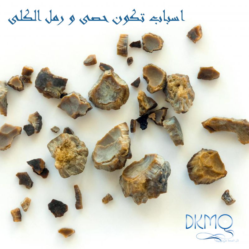 dkmoclinics's tweet photo. #اسباب تكون رمال و #حصى #الكلى
https://t.co/olqnv0hLi5
#صحة #دكمو #الكويت #kuwait #حصوات #أمراض_الكلى http://t.co/VM4KgYJb1A