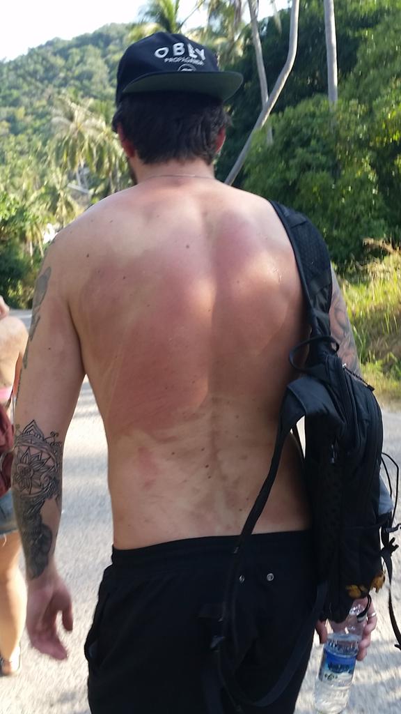 Junezasheim's tweet photo. Ska være flaut å spørre om hjelp med solkremen når du heller velge å ta der du strekk til sjøl og får det fine skille http://t.co/rQkYq0LZp9