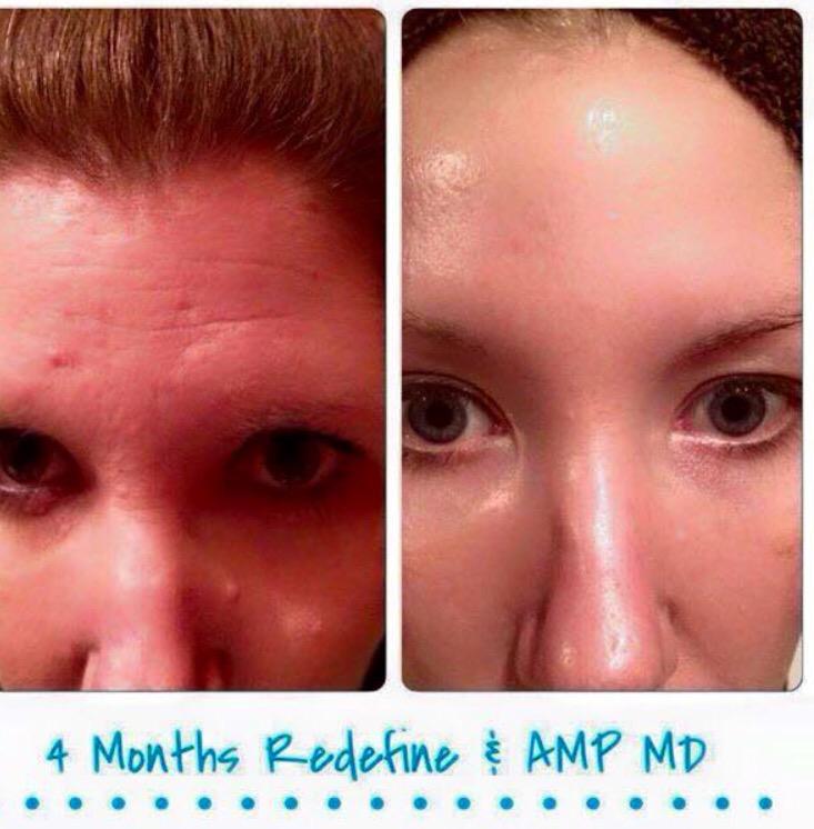 Jamiesperaw's tweet photo. Can't deny these results! #lovemyjob #changinglives https://t.co/7tslTLLpT5 http://t.co/5MifDtLrKx