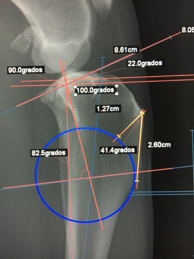 atraumaticvet's tweet photo. Parece complicado Pero es fácil ! Simplemente hay que ser metódico Son 4 pasos!!! método para hacerlo? 29 abril Ibiza http://t.co/qyAfBRUHdd
