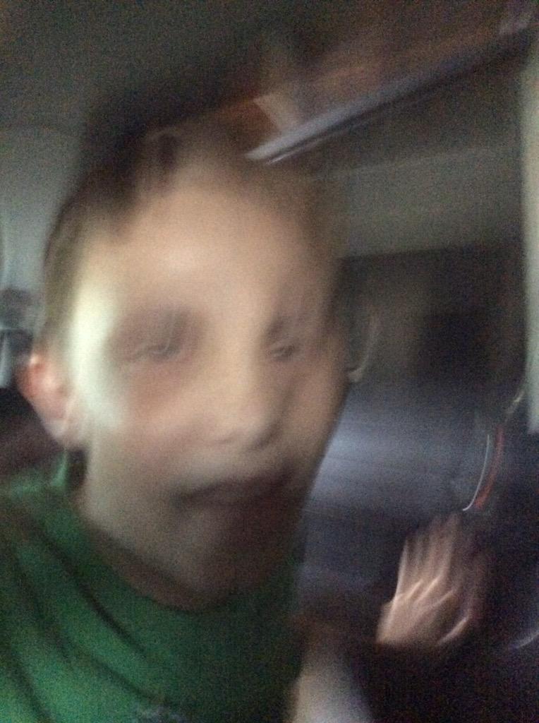 BrandonThe07's tweet photo. What's Happening To His Face http://t.co/qdqOnlYXtx