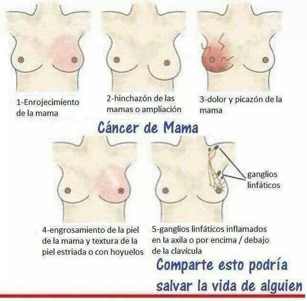 _Paisajes_'s tweet photo. AMIGAS Y AMIGOS,LES PUEDO PEDIR UN FAVOR? DEN RT  A "ESTO" PODEMOS SALVAR UNA VIDA! MUCHÍSIMAS GRACIAS POR HACERLO! http://t.co/b93UjuVI6W