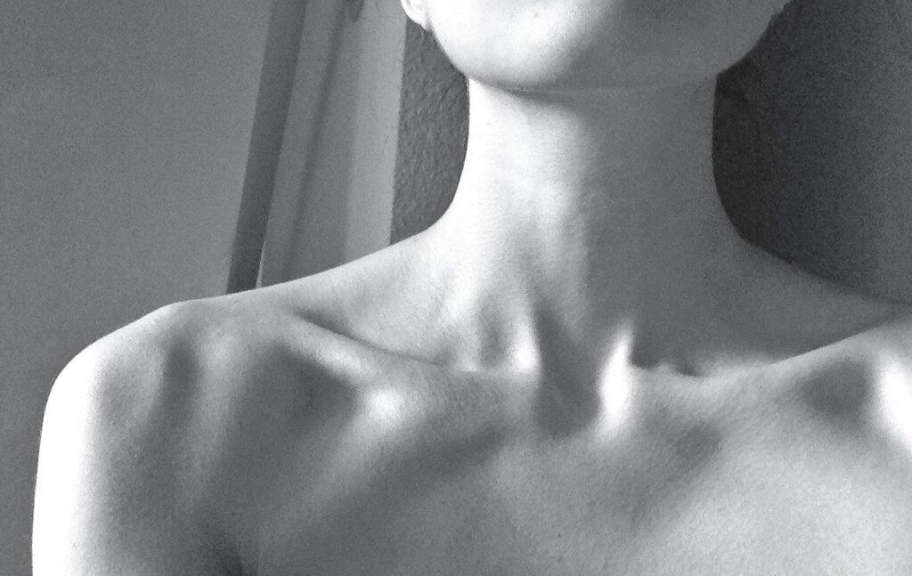 Ключицы у девушек. Торчащие ключицы. Торчащие ключицы. Гигрома грудино-ключичного сочленения. Шея девушки.