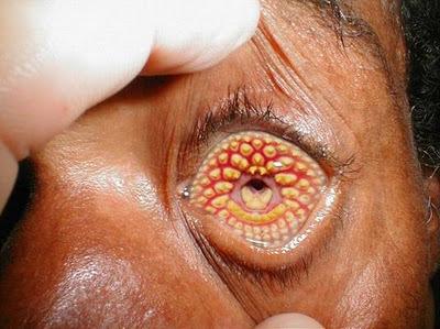 failstudents's tweet image. Weird Diseases That You Hardly Know (15 Photos)_\&amp;lt;&amp;gt; goo.gl/gprLdG