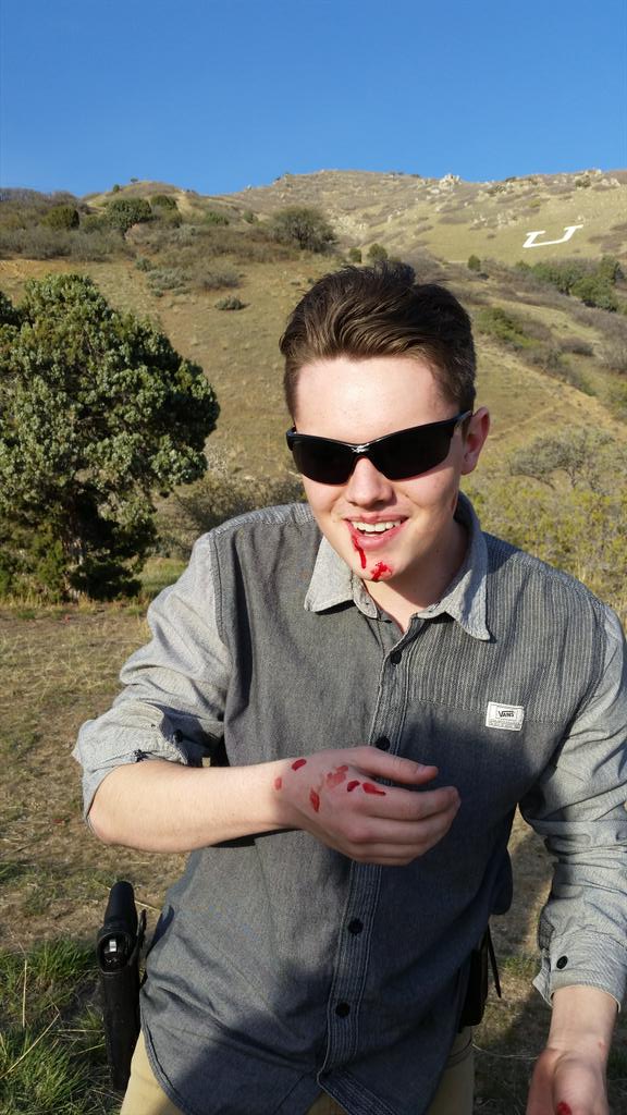 holmesco2's tweet photo. Getting grazed in the face by a bullet today made my life flash before my eyes! #gotshot http://t.co/SgsEnOTyoh