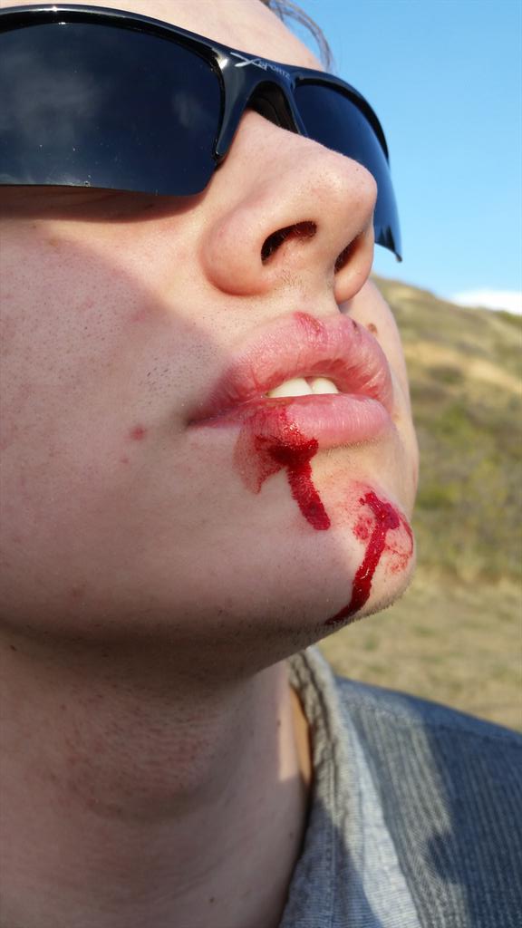 holmesco2's tweet photo. Getting grazed in the face by a bullet today made my life flash before my eyes! #gotshot http://t.co/SgsEnOTyoh